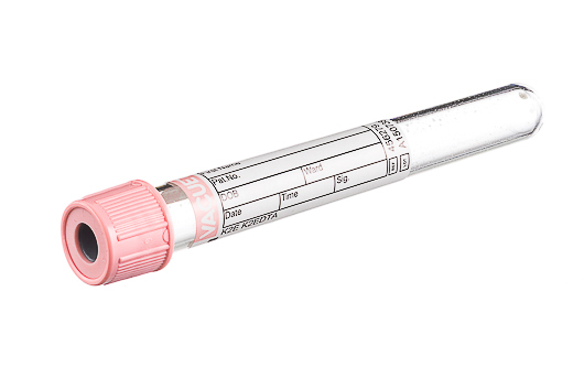 Greiner Bio-One Pink Top Tubes K2 EDTA Plastic 6ML 50/bx